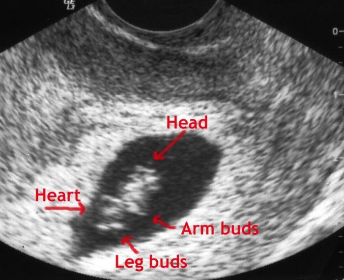 7 weeks gestation size of fetus