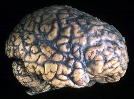 superficie mediale del cervello