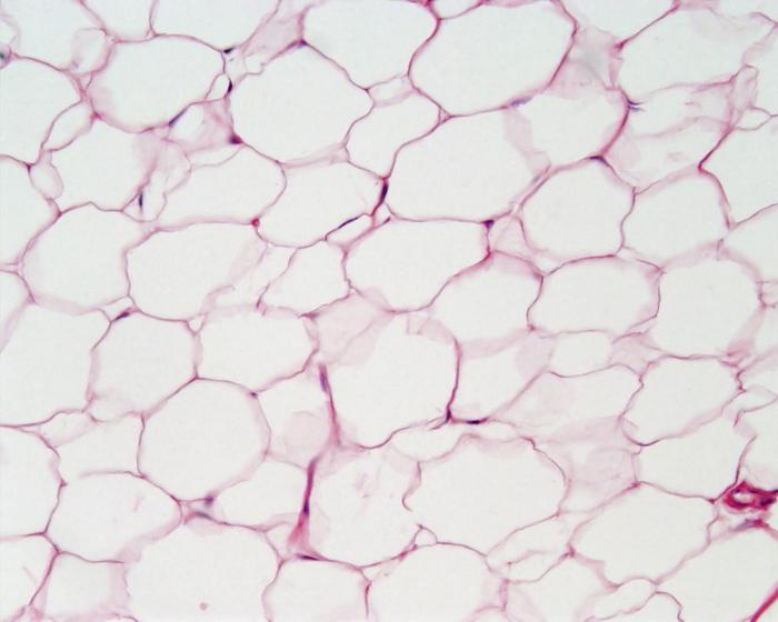 types of epithelial tissue