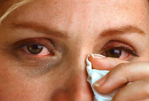 allergie aux yeux des enfants comment traiter 