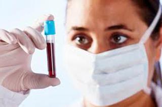 التهاب الكبد الوبائي اختبار الدم