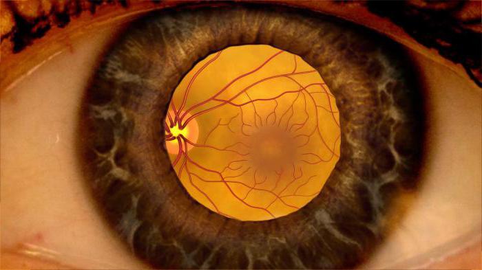 abiejų akių tinklainės kraujagyslių angiopatija