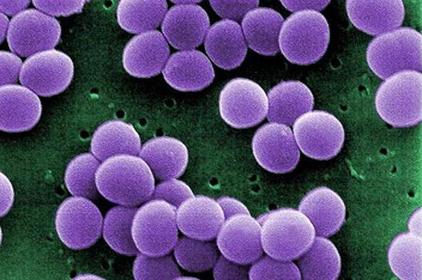 stafylokokken bacteriofaag met beoordelingen van furunculose