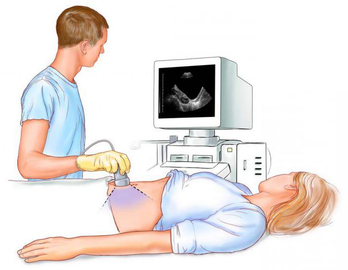 gravidanza tubarica come aborto tubarico