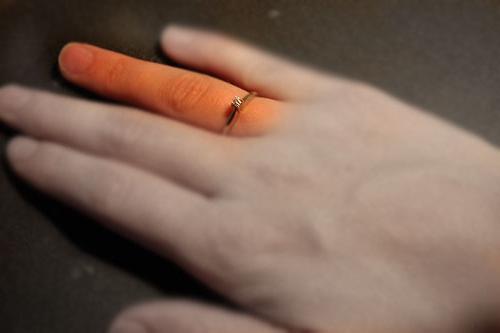 прстен прст