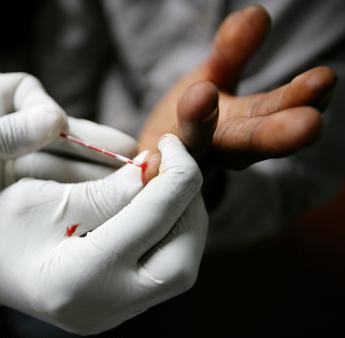 quali sono i sintomi degli ausili per l'hiv 