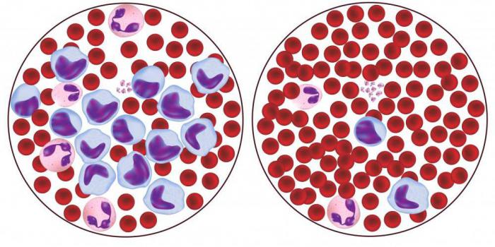 Niedrige rote Blutkörperchen