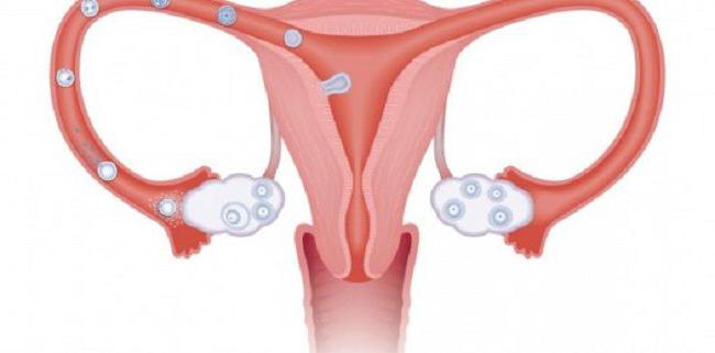 cilvēka spermas lielums un struktūra