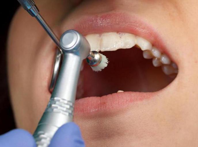 hypoplasia ของการเคลือบฟันในการรักษาเด็ก 