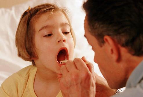 tonsillitis in children