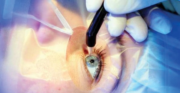 Øjenoperation