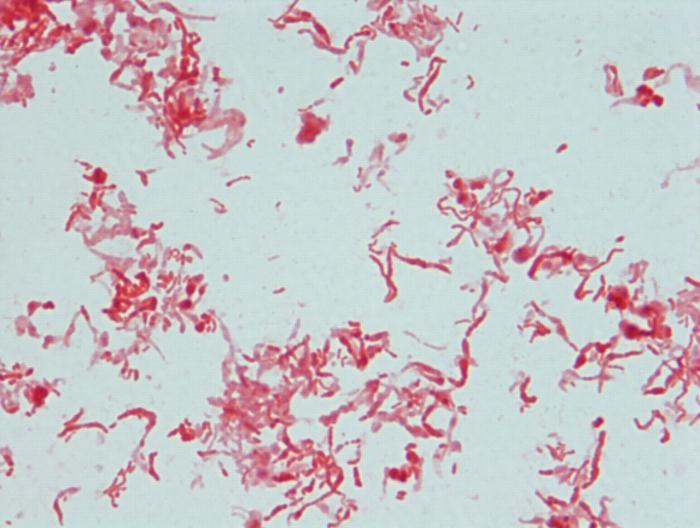 lactobacillus spp norm
