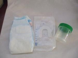 urinpose for nyfødte