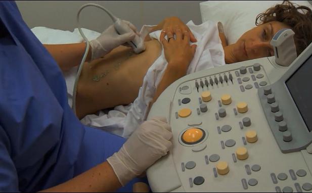 how to prepare an ultrasound abdomen
