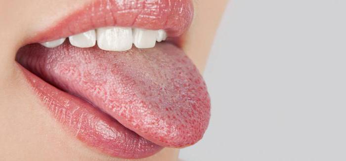 Duzzadt nyelv fogászati ​​nyomatokkal, kezelés