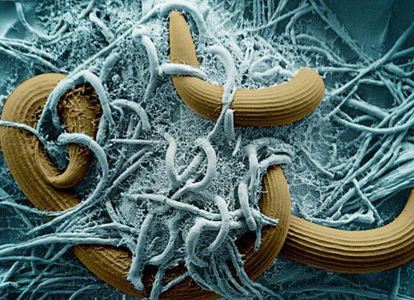 nematodi parassiti nell'uomo