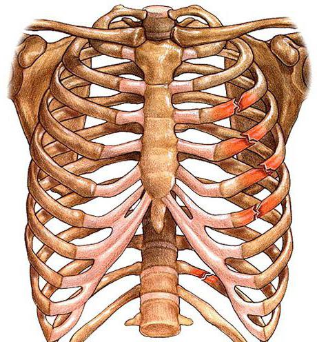 損傷のICD10の特徴に従った肋骨コードの骨折 