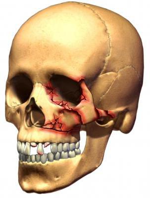 first aid for craniocerebral trauma