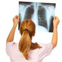 טיפול של pleurisy של הריאות