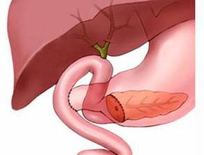 tratamiento de la enfermedad pancreática