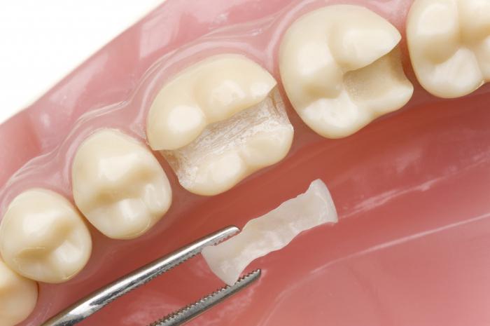 dental restaurering anmeldelser