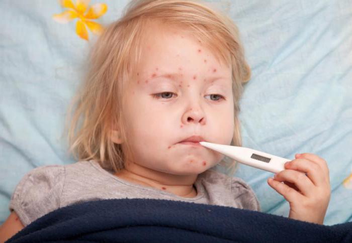 temperatura con la varicella nei bambini