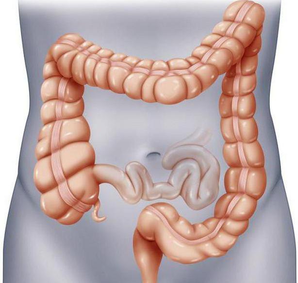 tuberculose intestinale