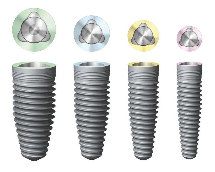 soorten tandheelkundige implantaten foto