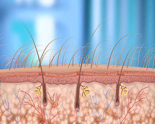 Inflammation i hårsäcken