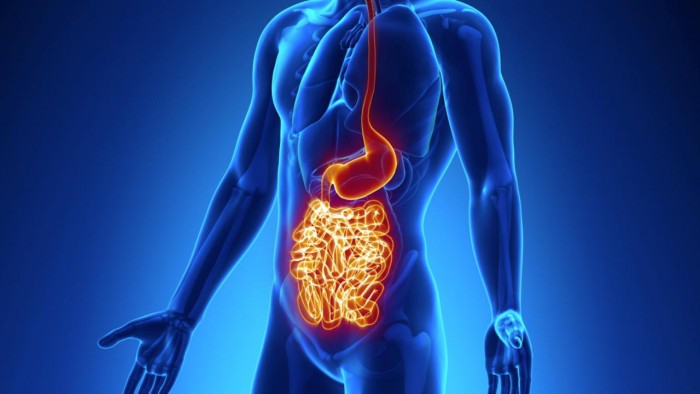 Crohnova bolest kao uzrok